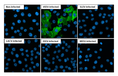 Anti-Venezuelan Equine Encephalitis Virus nsP1 antibody [HL1472] used in Immunocytochemistry/ Immunofluorescence (ICC/IF). GTX636946